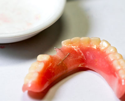 What Do I Do If I Damage My Dentures?
