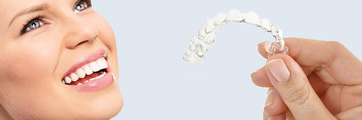 Mason 7 Things Parents Need to Know About Invisalign Teen
