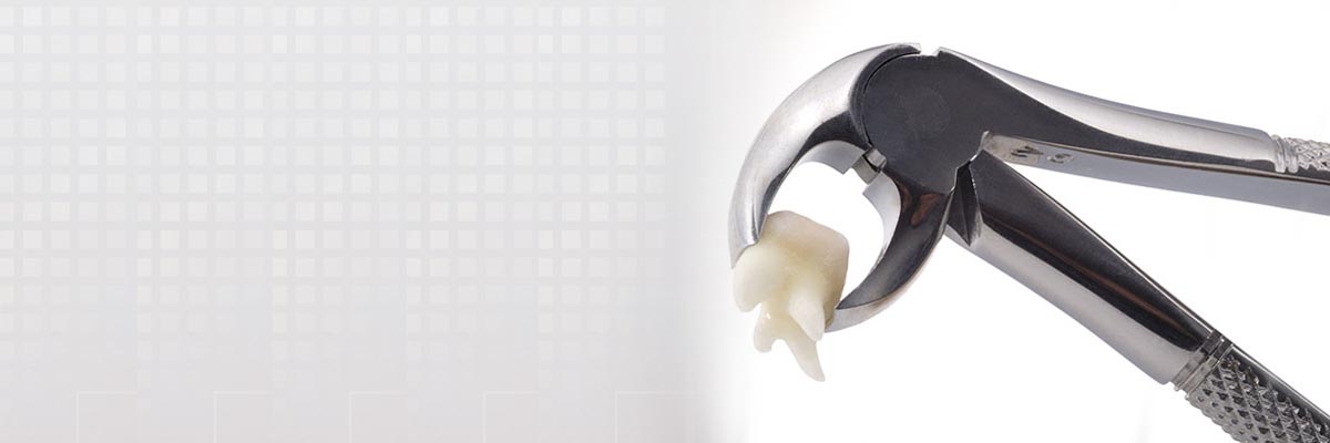 Mason Tooth Extraction